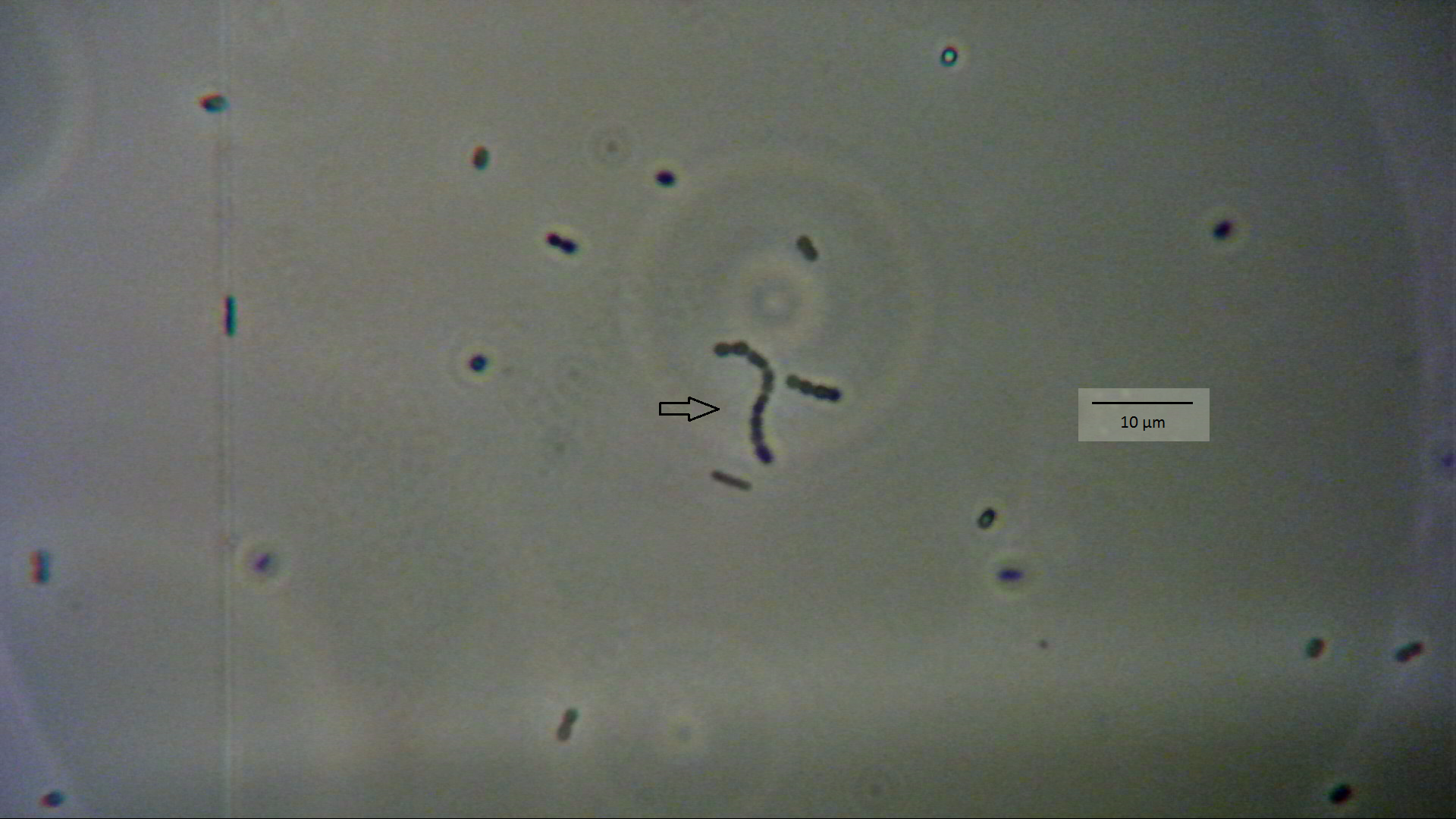 Foto23: Bakterien aus Joghurt im Phasenkontrast; der Pfeil zeigt Vertreter der Gattung Streptococcus ©M.Möller