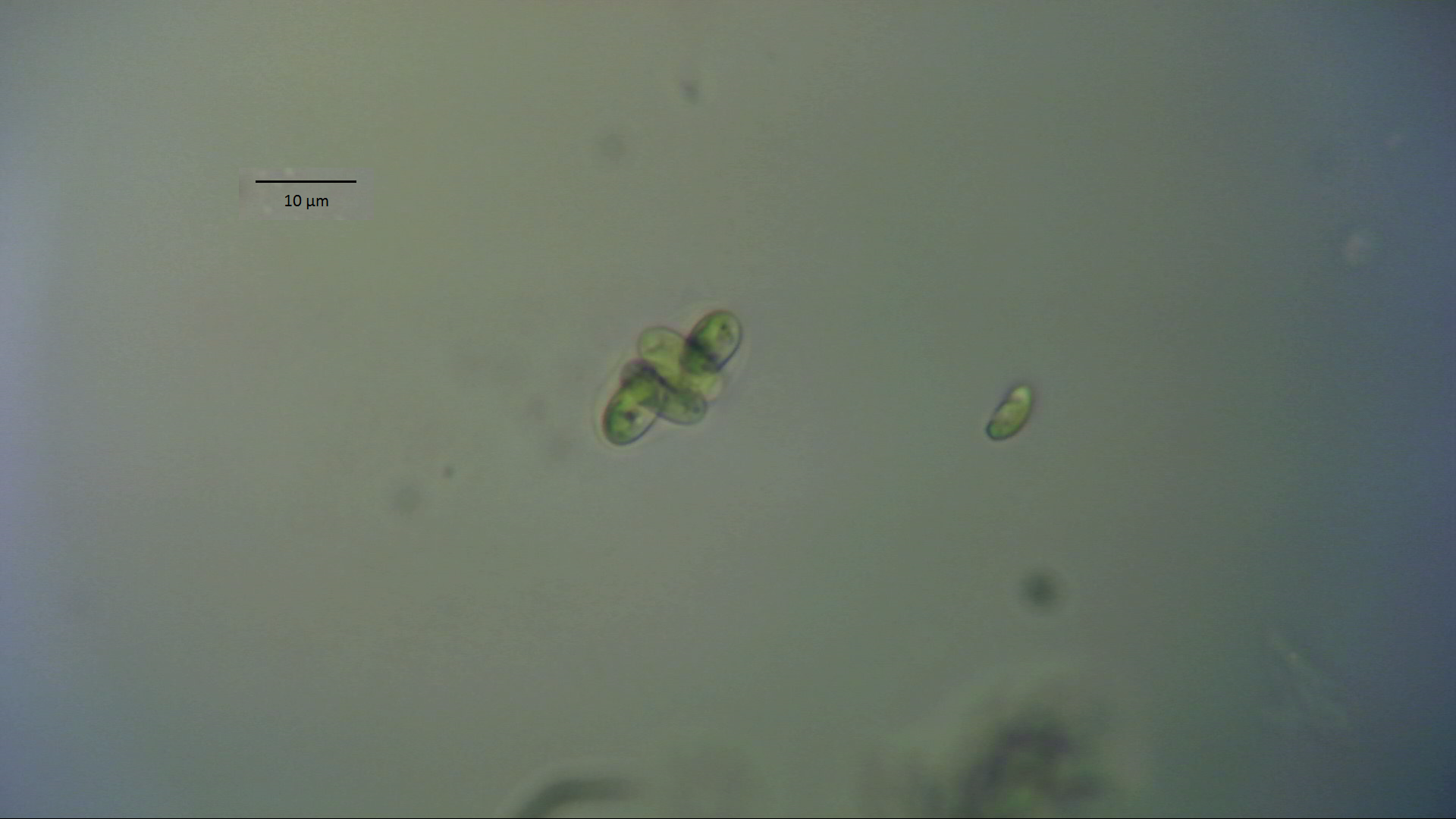 Foto26: Grünalgen der Gattung Oocystis ©M.Möller