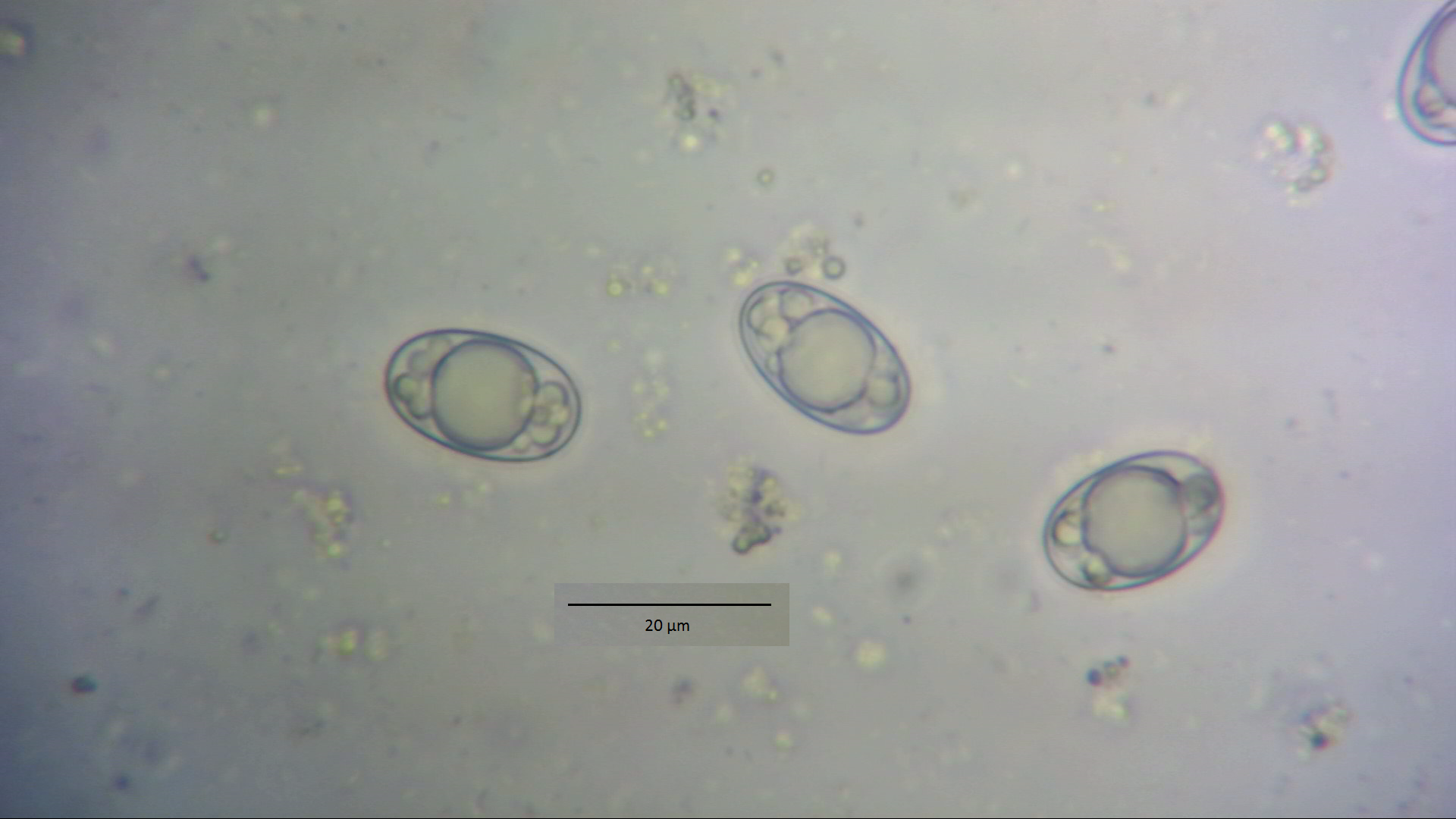 Foto16: Ascosporen von Hevella crispa ©M.Möller