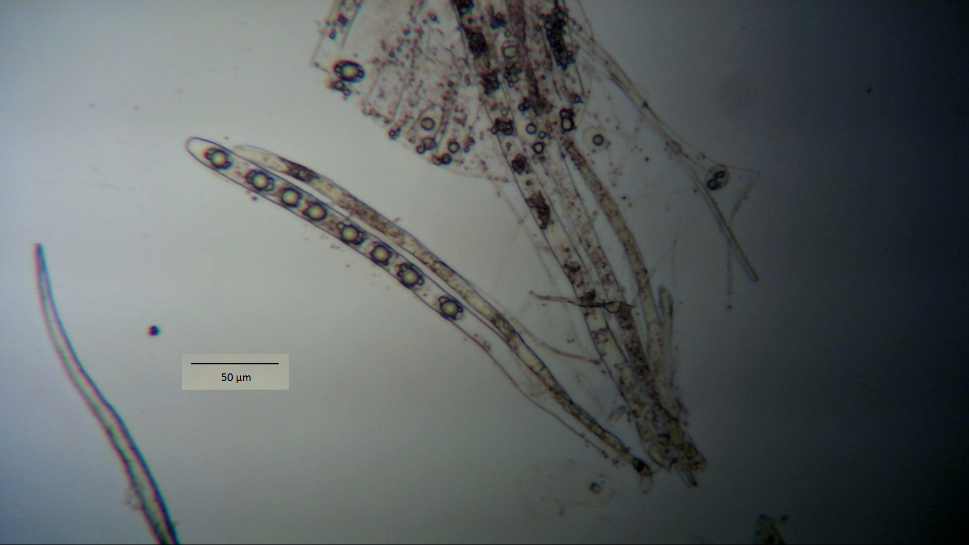 Foto14: Ascus von Helvella crispa ©M.Möller