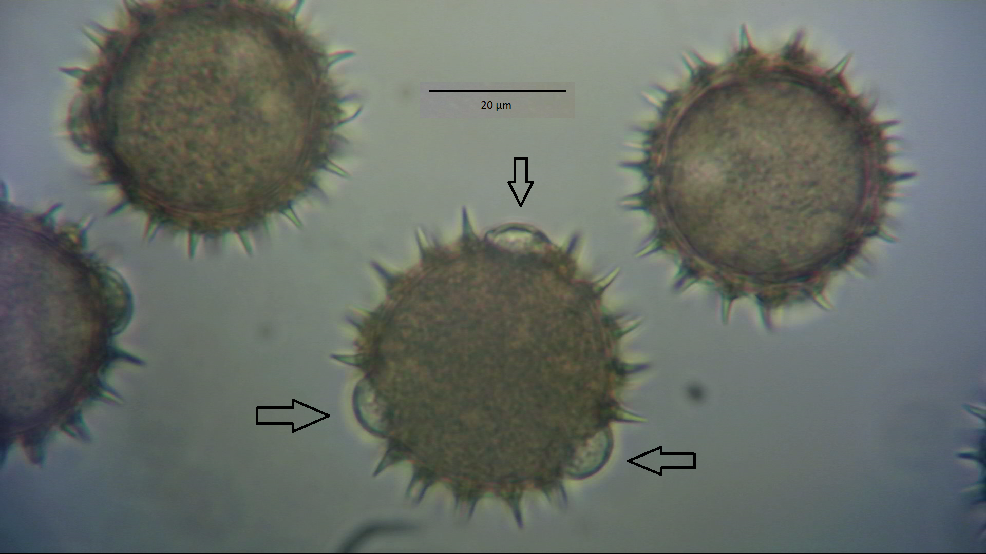 Foto11: Pollen der Sonnenblume (Helianthus annuus) bei stärkerer Vergrößerung ©M.Möller