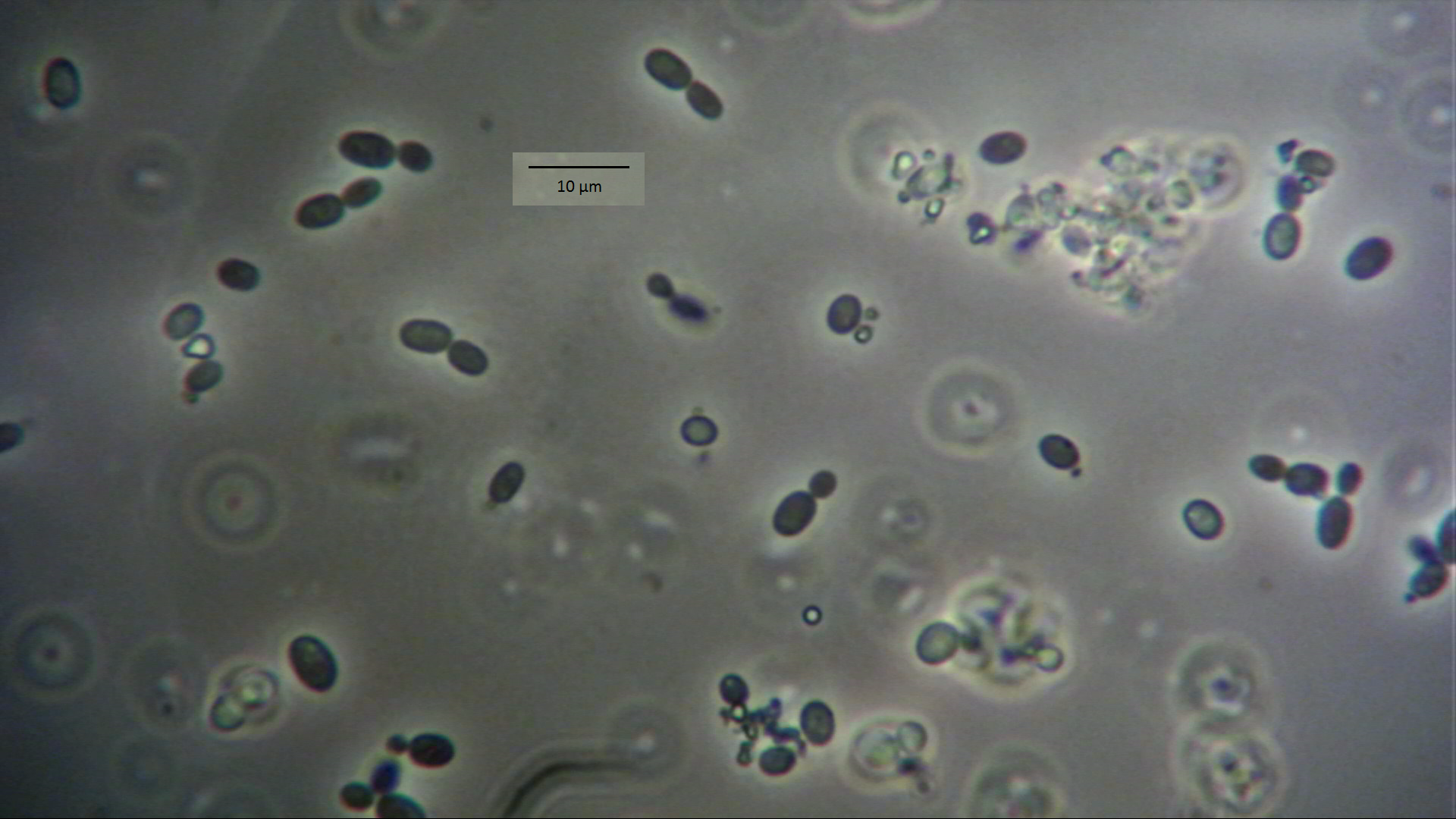Foto21: Zellen der Pilzgattung Rhodotorula mikroskopisch©M.Möller