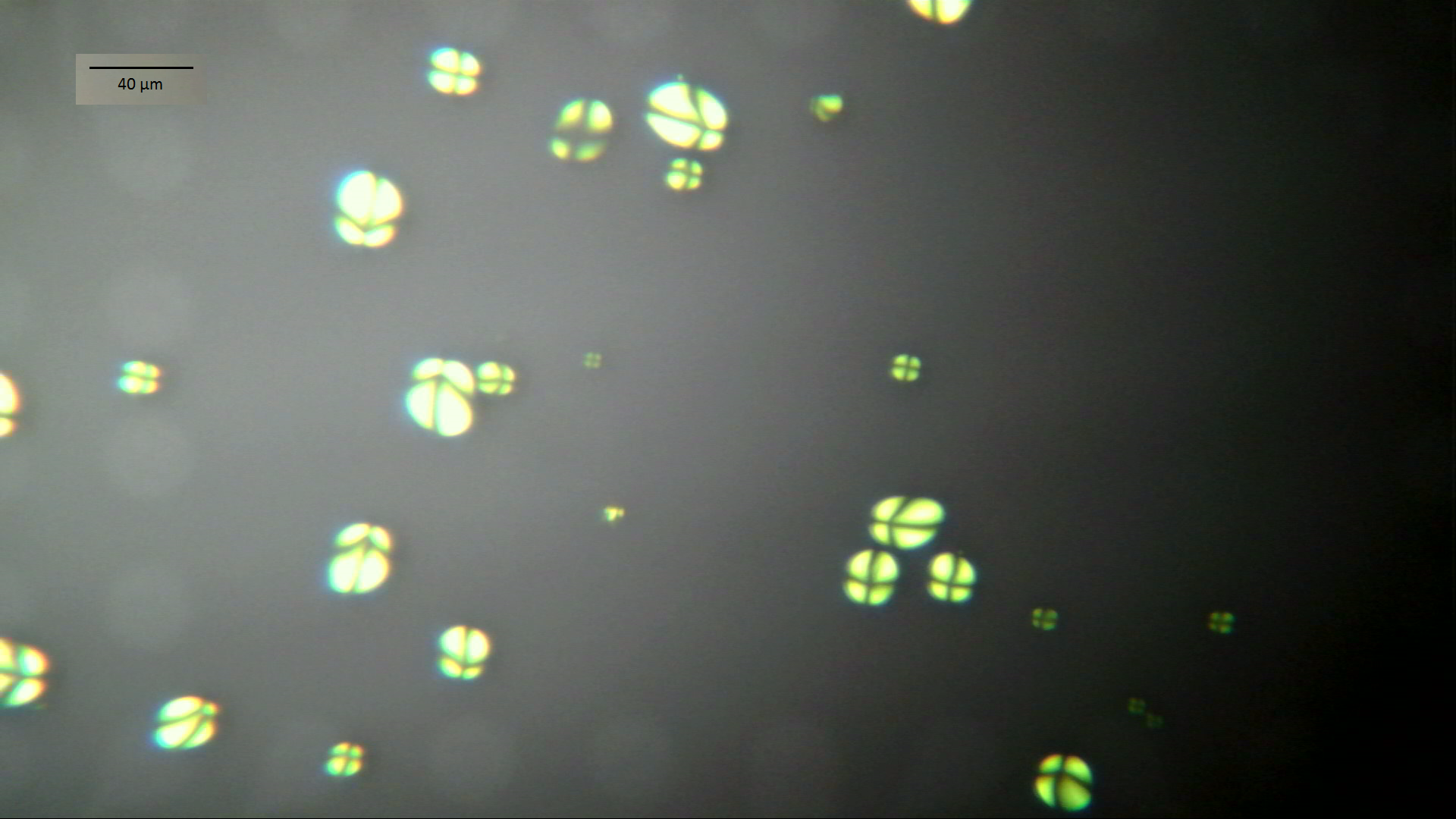 Foto31: Stärkekörner aus Kartoffelknolle im polarisierten Licht ©M.Möller